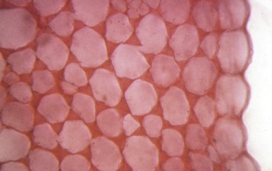 Collenchyme