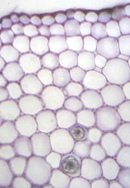 Parenchyme de réserve