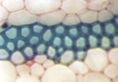 Sclérenchyme