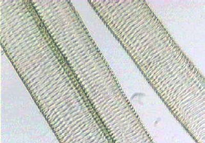 Tracheïdes scalariformes