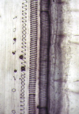 Tracheïdes annelés, spiralés et réticulés