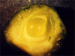 coupe d'ovule Ginkgo biloba