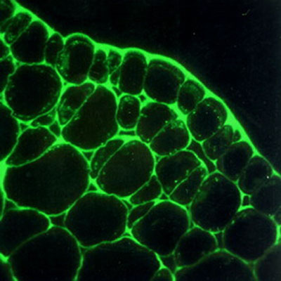 hypocotyle de soja