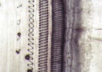 xyleme1mpa-g.jpg