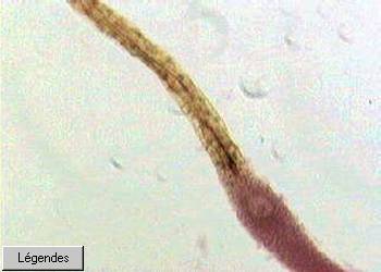 bryo-archegonemousspg-g.jpg