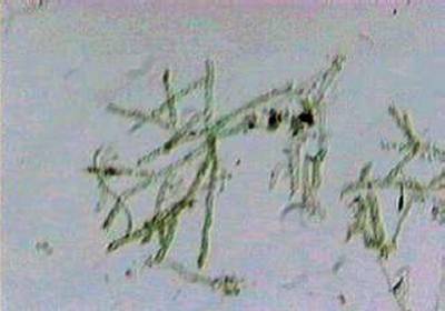 byro-protonemapg-g.jpg