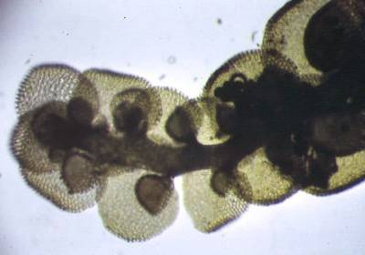 frullania1mpa.jpg