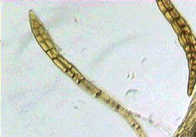 paraphyse_moussepg.jpg