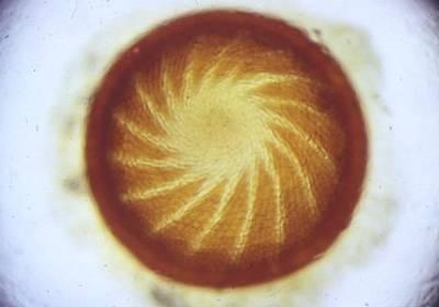 peristome2mpa.jpg