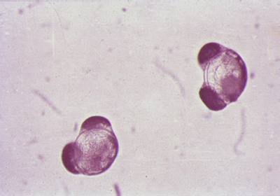 pollenpin2mpa.jpg