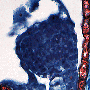 globulaire