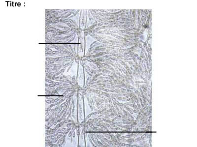 image &agrave; l&eacute;gender